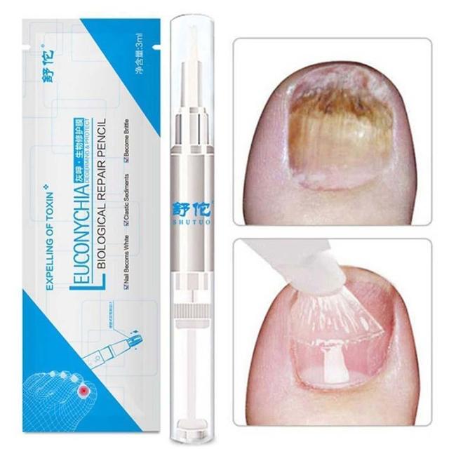 CLINAIL™ : Advanced Fungal Nail Repair Pen