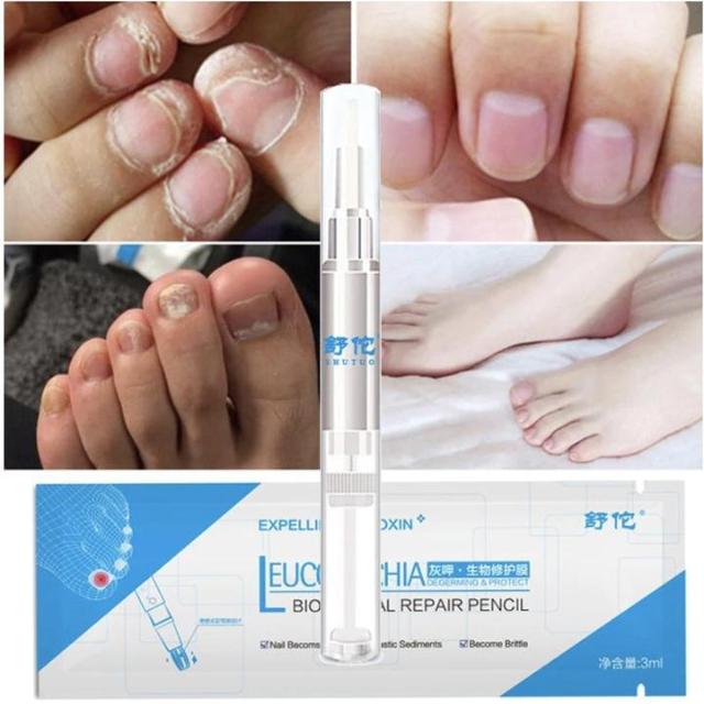 CLINAIL™ : Advanced Fungal Nail Repair Pen