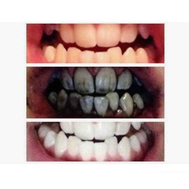 WHITEETH™ : Natural Bamboo Charcoal Teeth Whitening Toothpaste