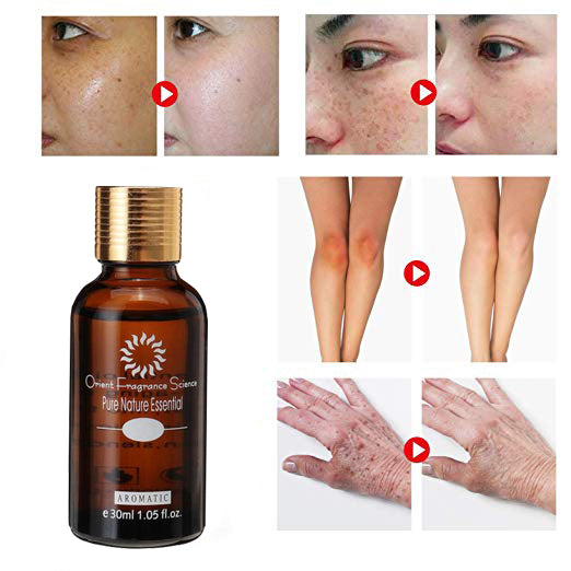 NOSPOT™: Ultra Brightening Spotless Oil