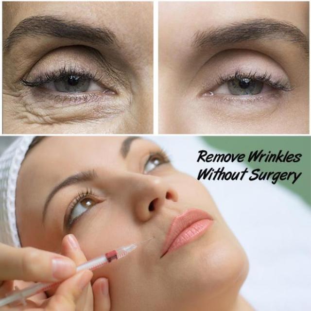 Ultra Thin Facial Lift Patches for Wrinkles & Lines (3 Types)