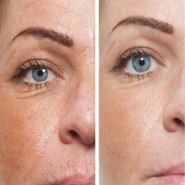 FACELIFT™ : Cirmage Facial Lifting Beauty Stick