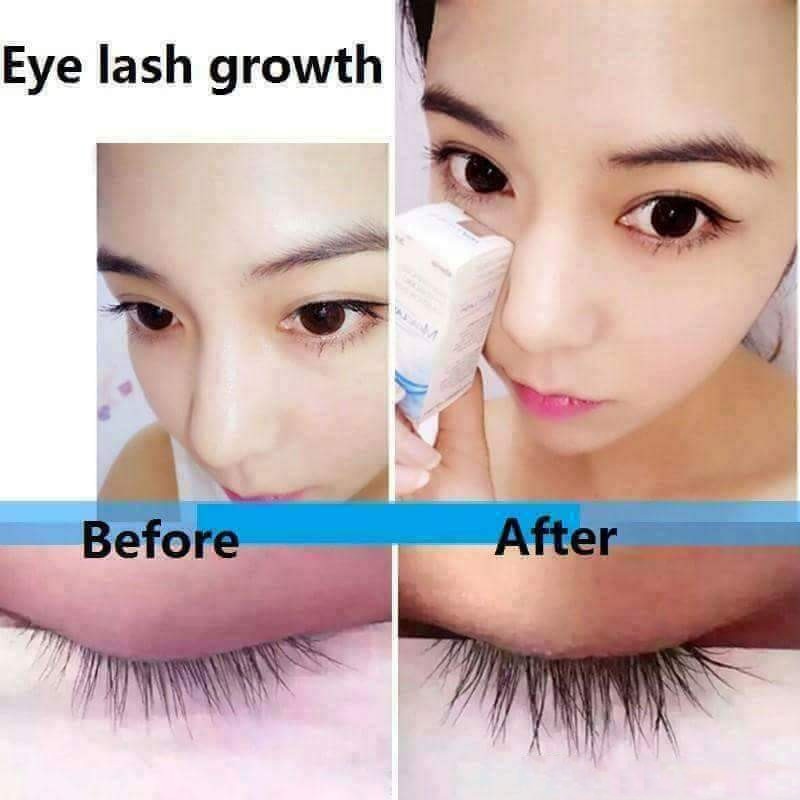 LASHY™ : Eyelash-Eyebrow Growth Enhancer