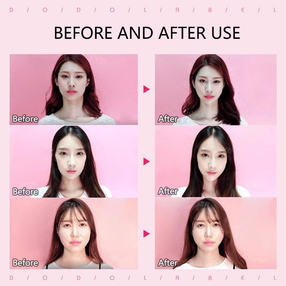 LIFTER™ : Invisible Face Lift Sticker