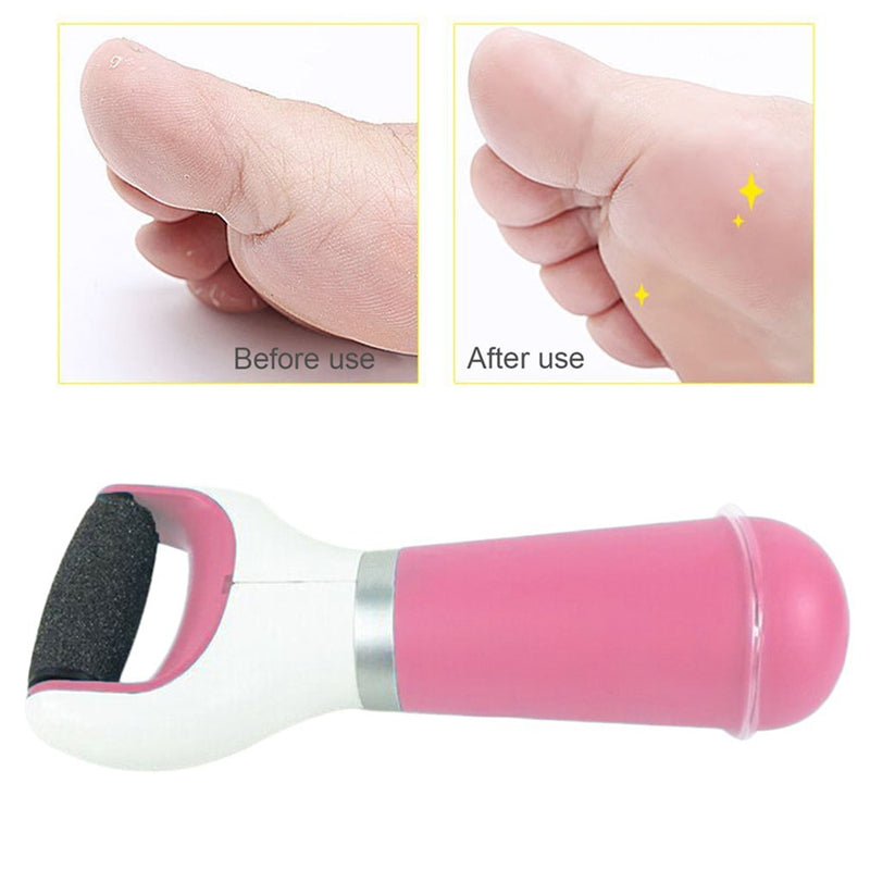 CALUVER™: Electric Callus Remover