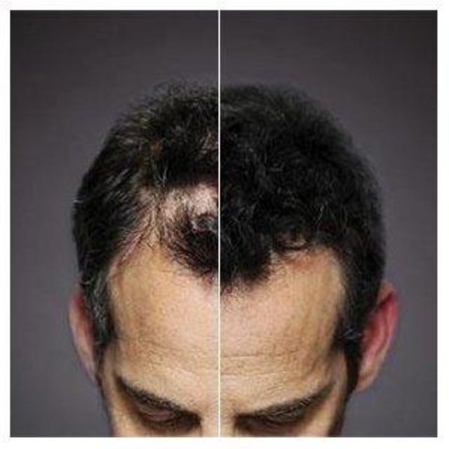 HAIRFI™ : Hair Building Fibers