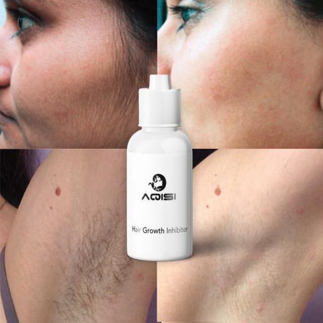 EASEPIL™ : Hair Growth Inhibitor