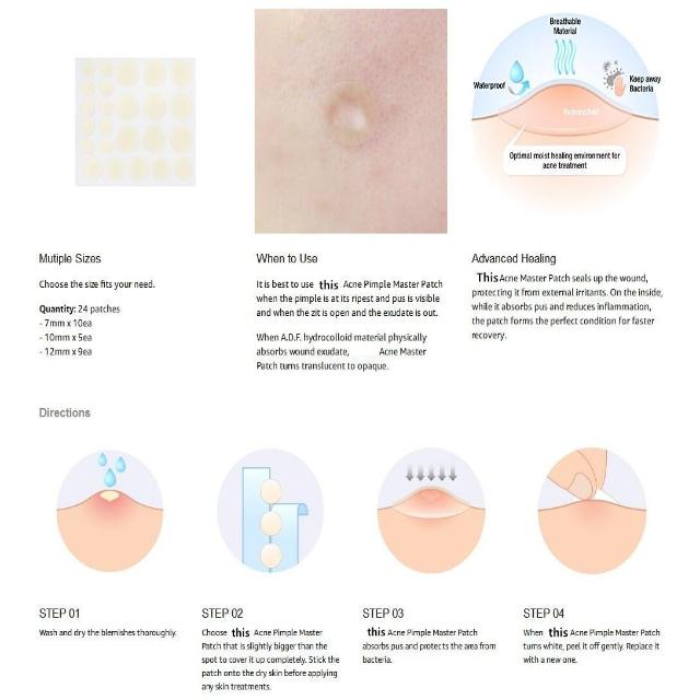 AKNY™ : Hydrocolloid Invisible Acne & Blemish Skin Patch (120 PCS)