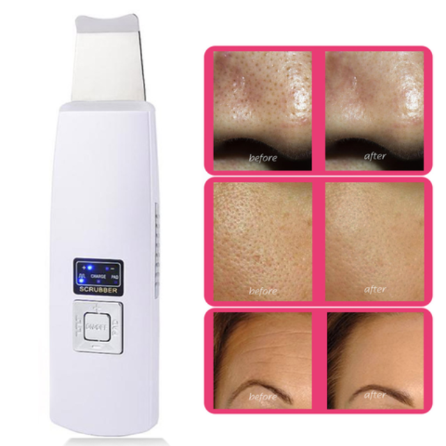 SPASkin™ : Ultrasonic Ion Skin Scrubber