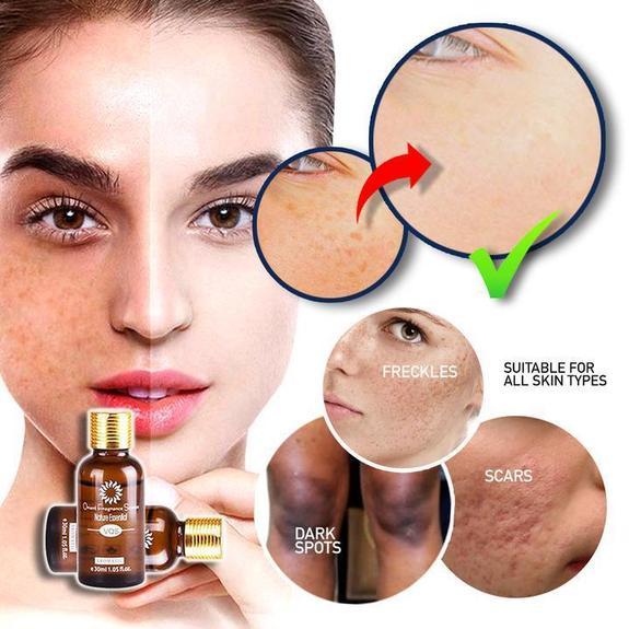 NOSPOT™: Ultra Brightening Spotless Oil