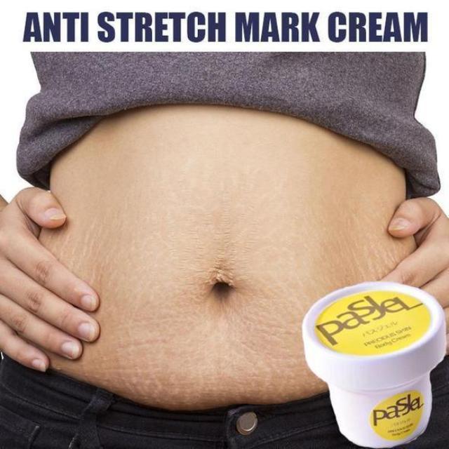 MARKGON™ : Stretch Mark Removal Cream
