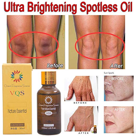 NOSPOT™: Ultra Brightening Spotless Oil