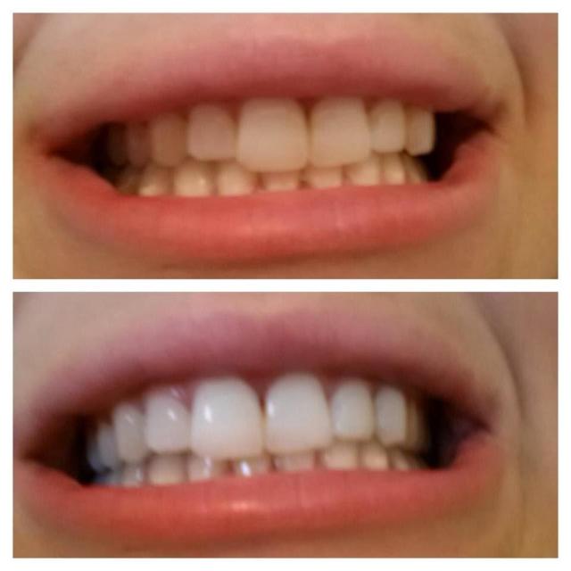 WHITEETH™ : Natural Bamboo Charcoal Teeth Whitening Toothpaste