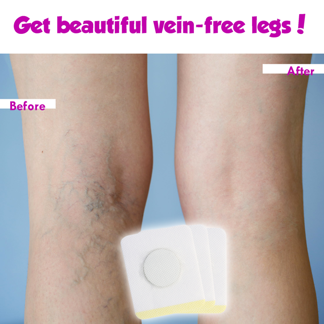 VAPATCH™ : Herbal Varicose Veins Soothing Patch (40 PATCHES)