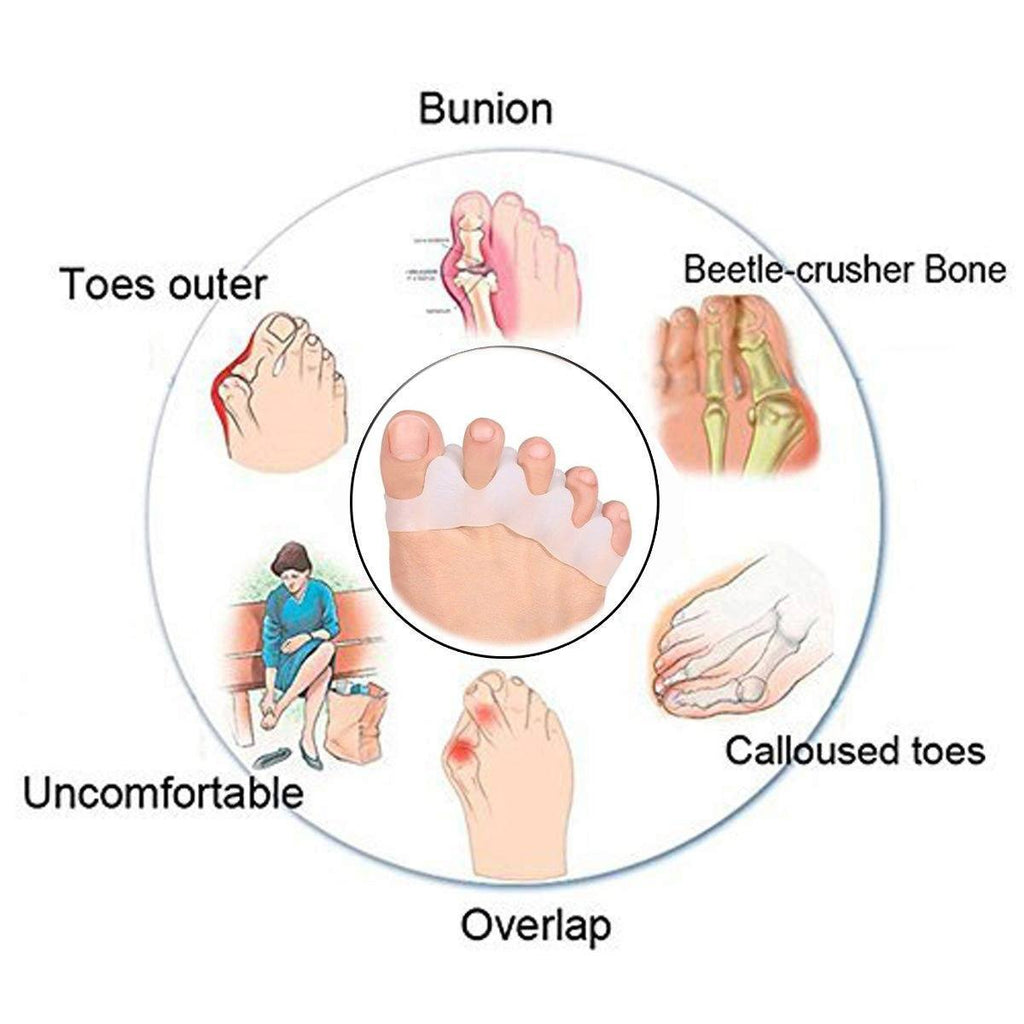 SEPATO™: Therapeutic Toes Separator