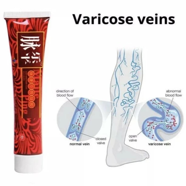 VARIXON™ : Natural Varicose Veins Removal Cream